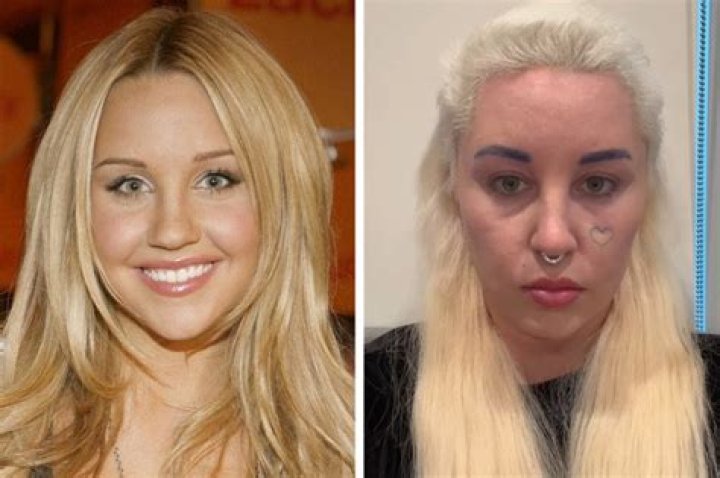 Amanda Bynes Now: A Comprehensive Look at Her Journey and Current Status