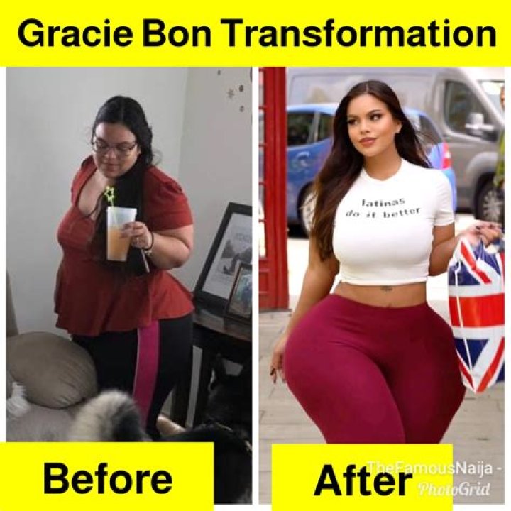 Before Gracie Bon's Surgery: A Look Back