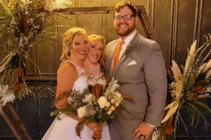 Brittany and Abby Hensel Wedding: A Unique Celebration of Love and Unity