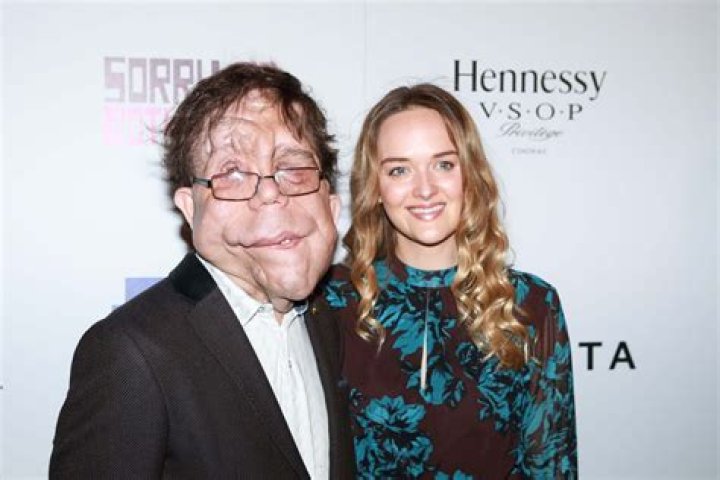 Discovering Adam Pearson's Life with His Wife Merritt