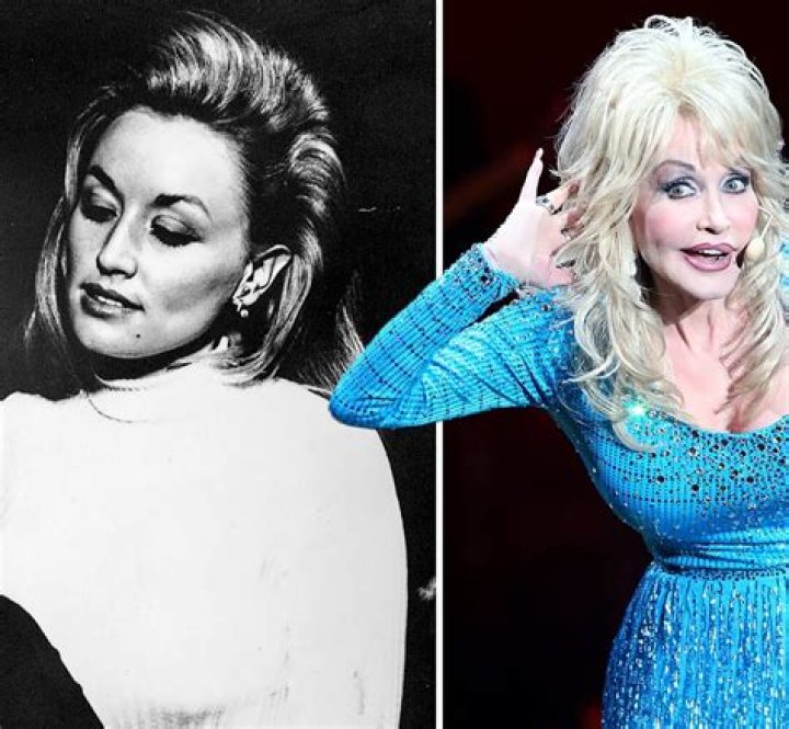 Dolly Parton: Unveiling the Icon Without Her Signature Wig