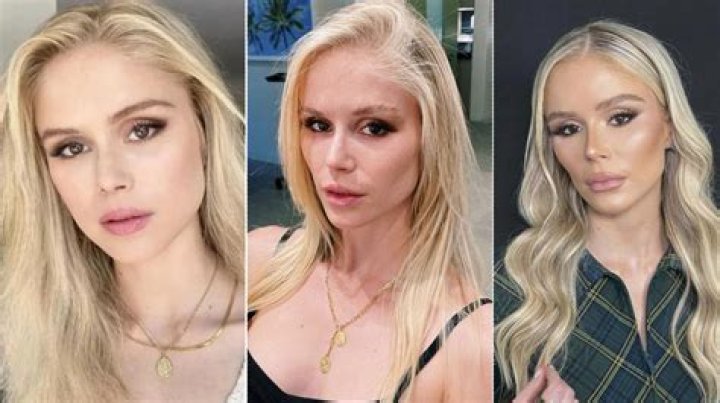Erin Moriarty Plastic Surgery: The Truth Behind Her Transformation in The Boys