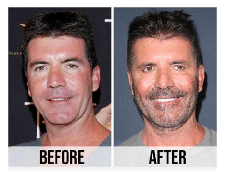 Exploring the Speculations: Has Simon Cowell Died?
