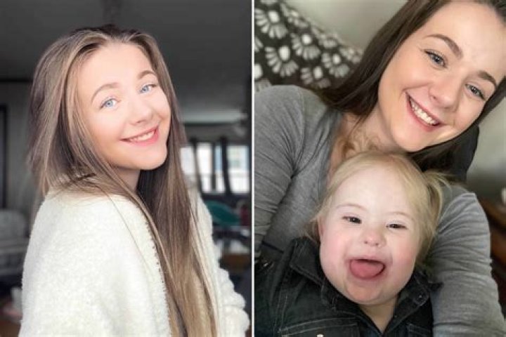 George Clooney's Twins and the Challenge of Down Syndrome