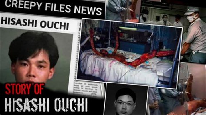 Hisashi Ouchi Real Video: The Untold Story Behind the Tragic Incident