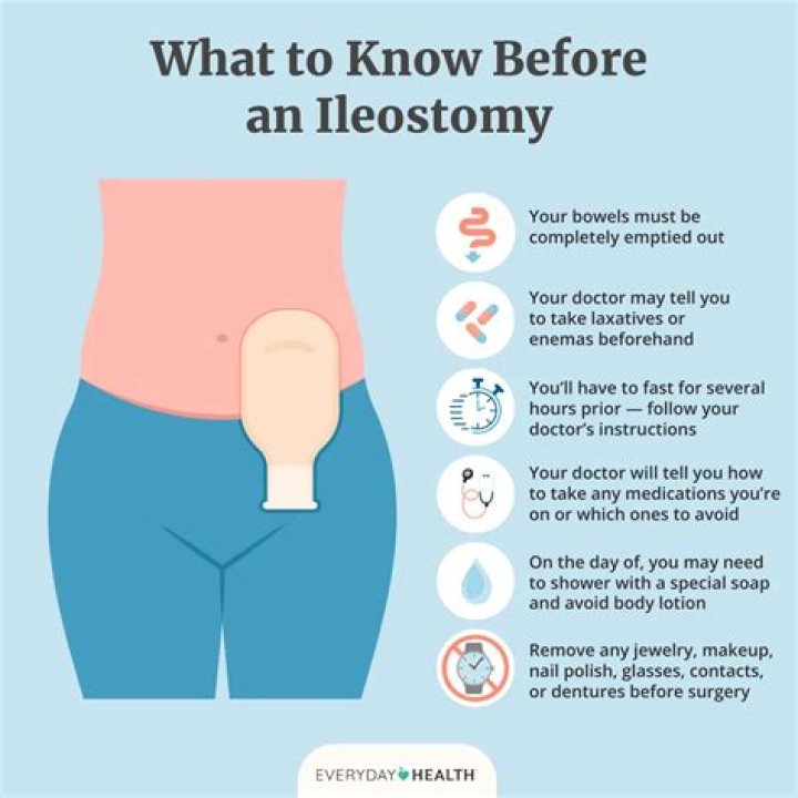 Ileostomy: A Comprehensive Guide to Understanding Kat Timpf's Journey