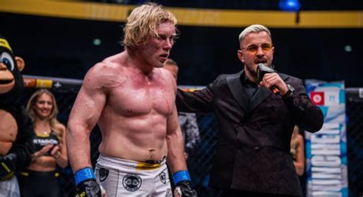 Is Brock Lesnar an Albino? | True or False