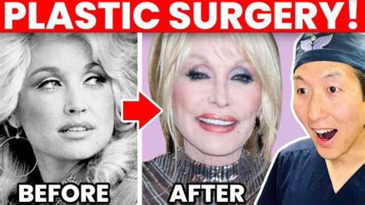 JT Before Surgery Pictures: A Comprehensive Insight into His Transformation