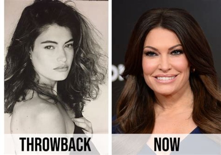 Kimberly Guilfoyle: Before and After Surgery - Transformation Revealed