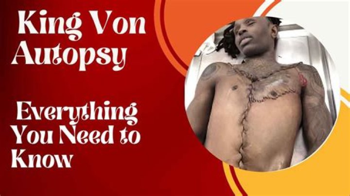 King Von Autopsy Leak: The Shocking Truth Unveiled