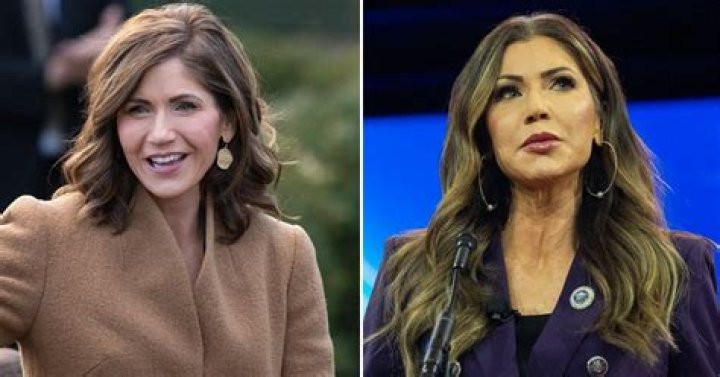 Melissa Rivers Plastic Surgery Journey Transformation: A Candid Look