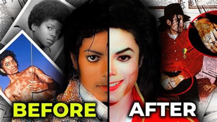 Michael Jackson: Before and After - A Journey Through Transformation