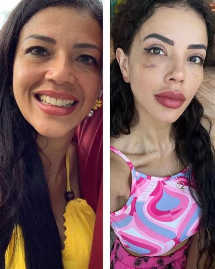 Nikki from 90 Day Fiancé: A Journey Before Surgery