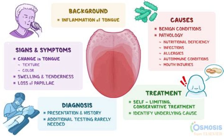 NTR Mening: Understanding the Symptoms, Causes, and Treatment Options