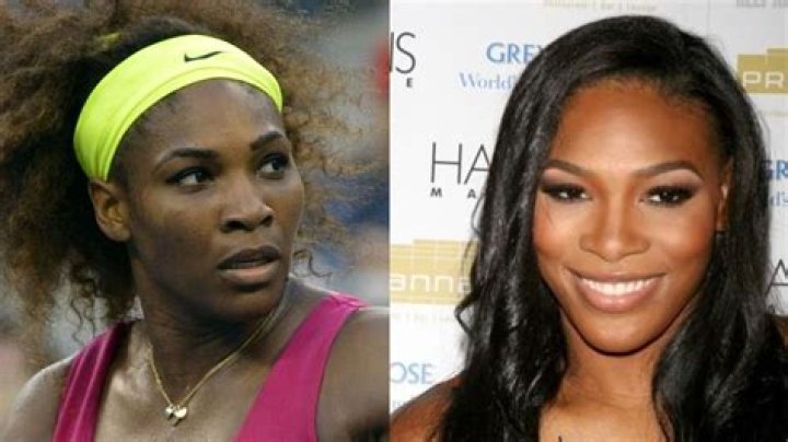 Serena Williams Before Plastic Surgery: A Comprehensive Look