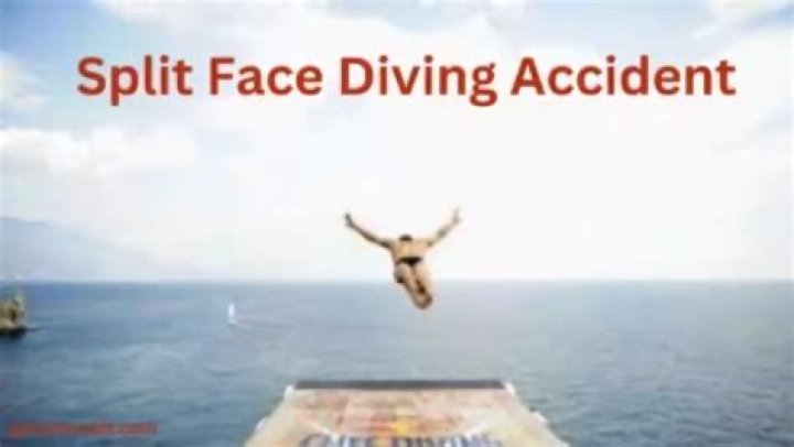 The Comprehensive Analysis of the Split Diving Incident: Lessons and Insights