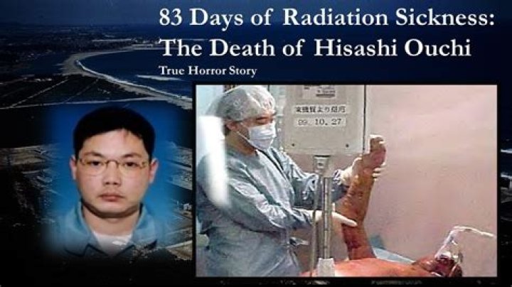 The Harrowing Story of Hisashi Ouchi: A Tragic Encounter with Radiation at Tokaimura