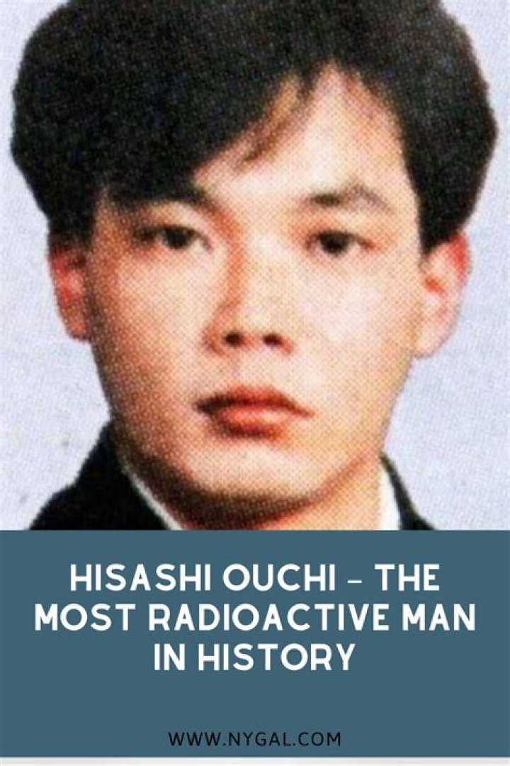 The Tragic Story of Hisashi Ouchi: A Journey Through History, Science, and Humanity