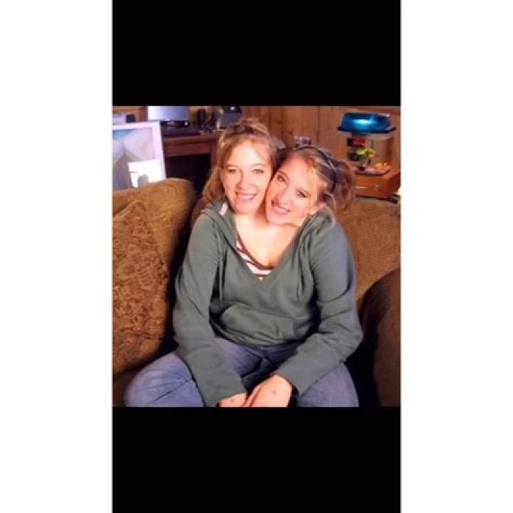 Unraveling the Lives of Conjoined Twins Abby and Brittany