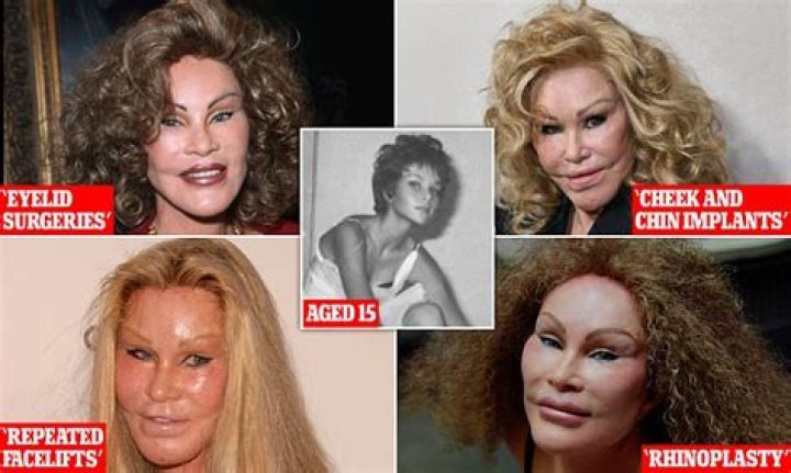 Unveiling the Intriguing Life of Jocelyn Wildenstein Before Surgery