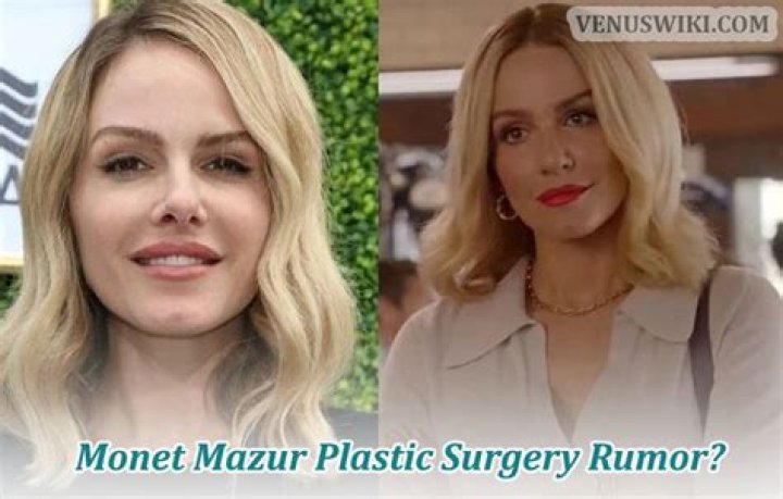 Unveiling the Truth Behind Monet Mazur Surgery