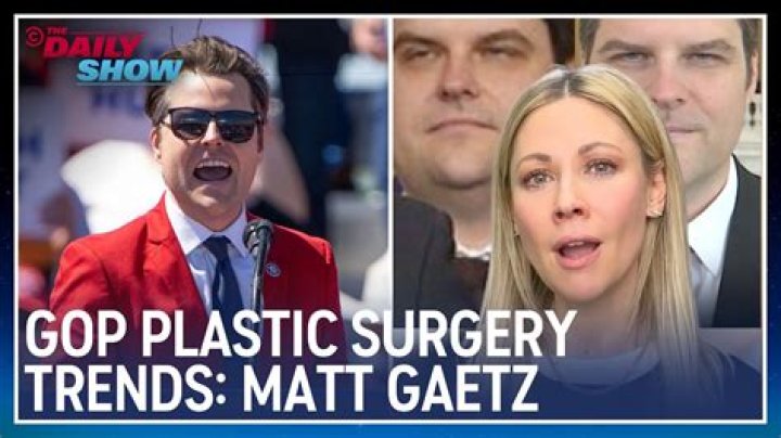 Unveiling the Truth: Mayt Gaetz Plastic Surgery