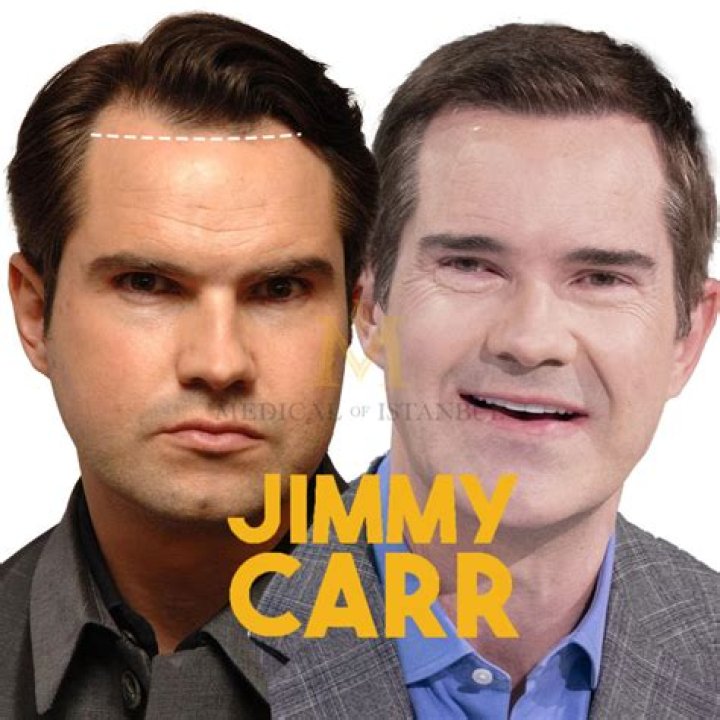 Who Is Jimmy Carr's Partner? A Comprehensive Look Into Their Relationship